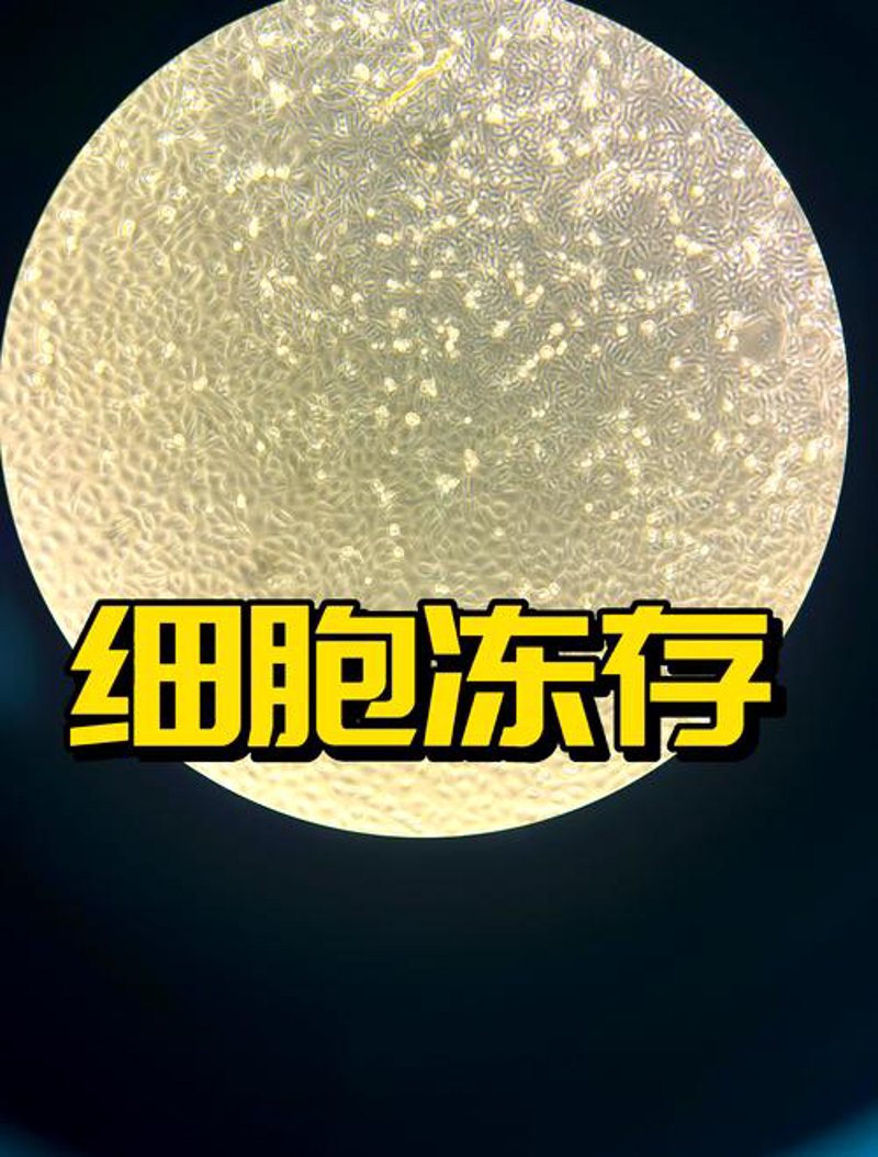 细胞储存:未来医疗的希望与挑战